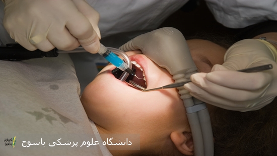 برای-نخستین‌بار⁄-انجام-عمل‌های-دندانپزشکی-اطفال-تحت-بیهوشی-در-بیمارستان-شهید-جلیل-یاسوج