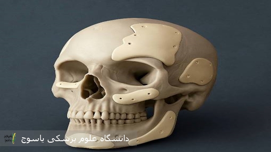 تحولی-نوین-در-جراحی-زیبایی-جمجمه-در-بیمارستان-دهدشت-با-فناوری-بازسازی-سه‌بعدی-